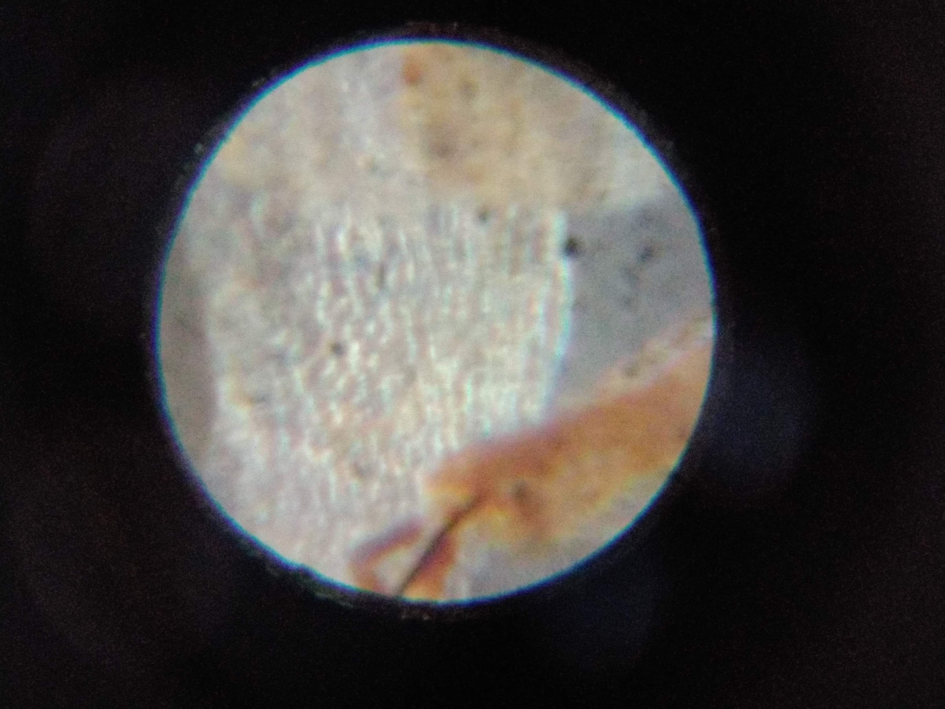Some debris seen from the micro-micro-scope